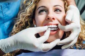 invisalign Dunfermline

