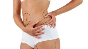 Fat Transfer in Dubai
