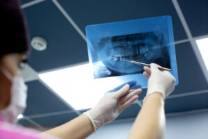 Dental X rays services in Oshawa