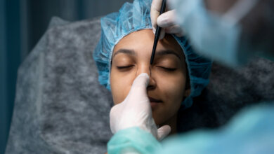 best rhinoplasty surgeon in hyderabad
