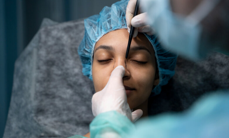 best rhinoplasty surgeon in hyderabad