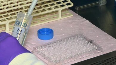 Cell Cytotoxicity Assay