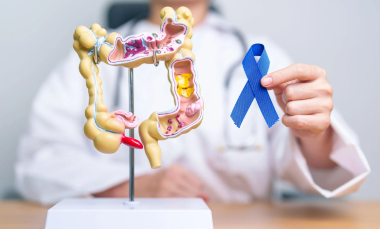 Colon Cancer Signs and Early Detection in Raquel