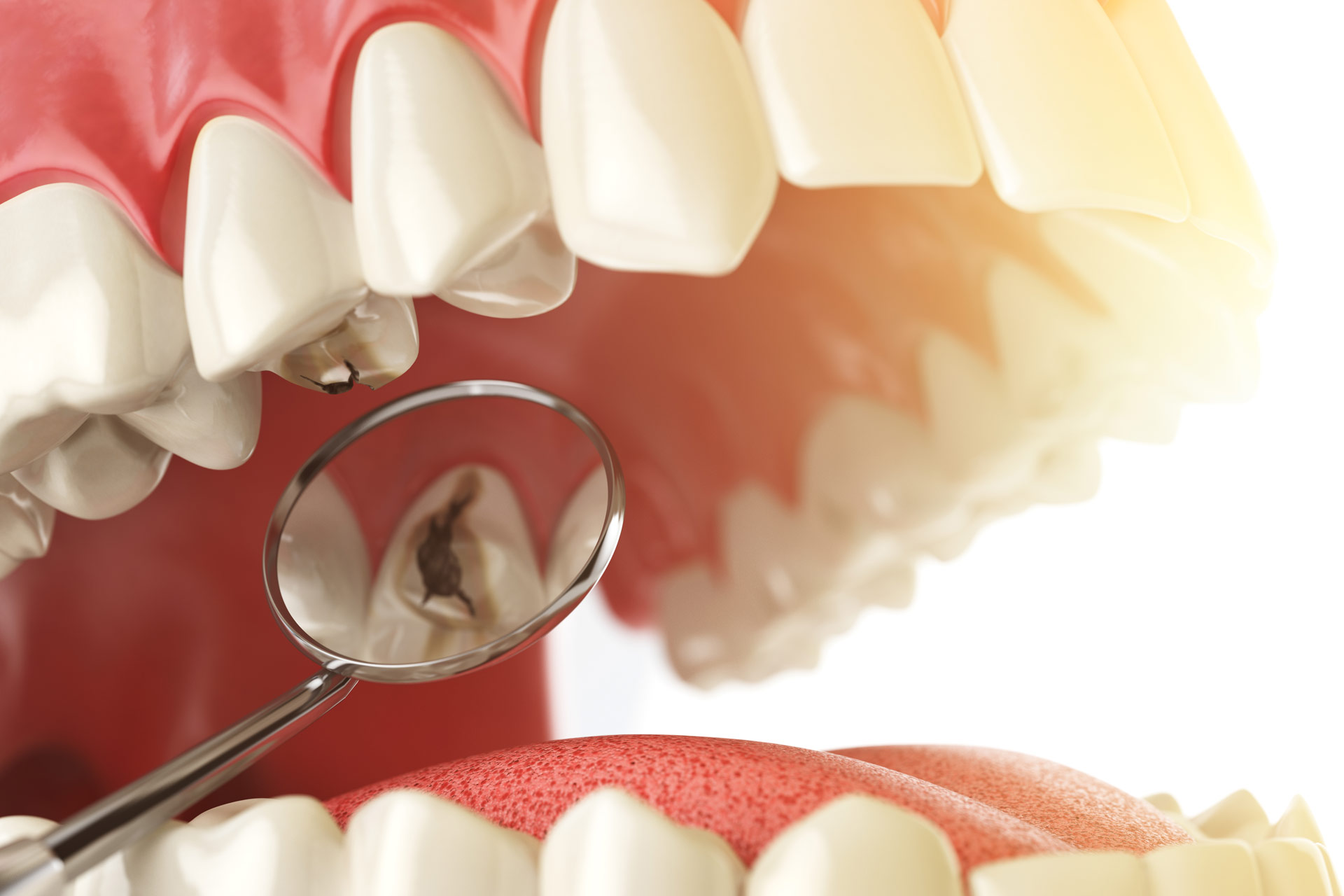 Early Cavity Signs You Should Never Ignore