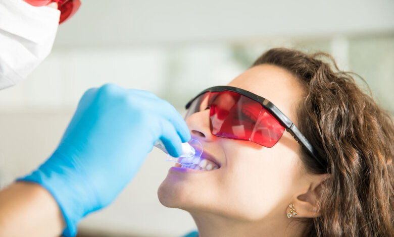 Foods and Drinks to Avoid After Teeth Whitening