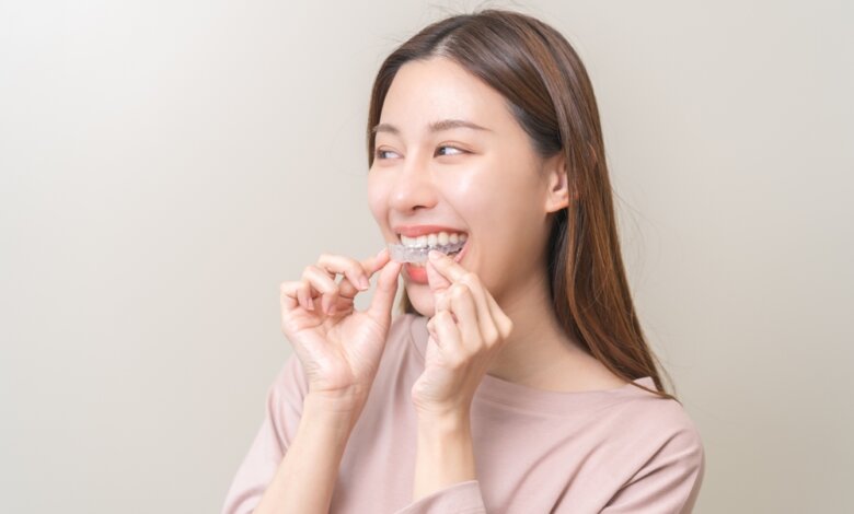 Invisalign
