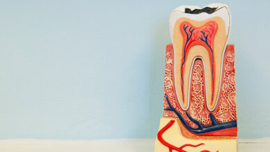 Root Canal Therapy in Newmarket