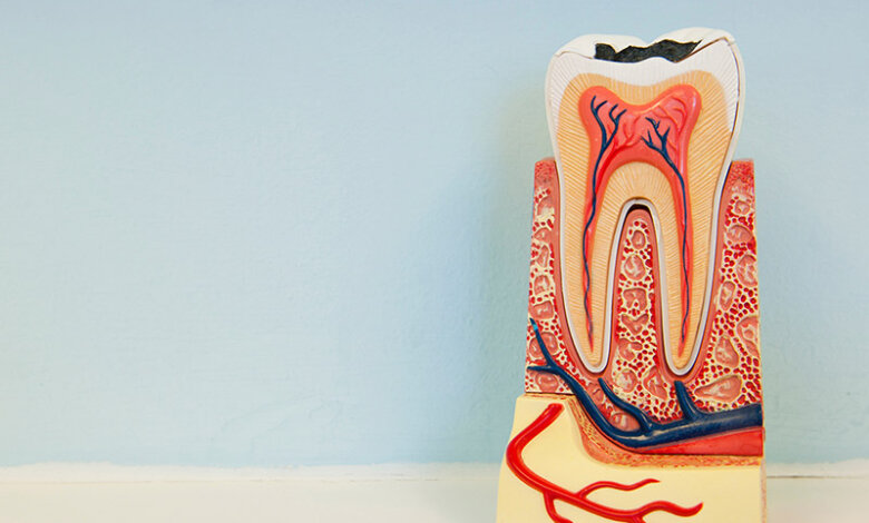 Root Canal Therapy in Newmarket