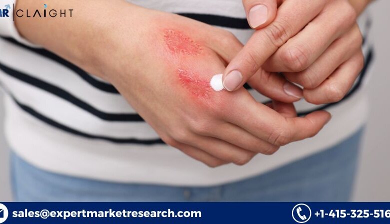 Topical Pain Relief Market