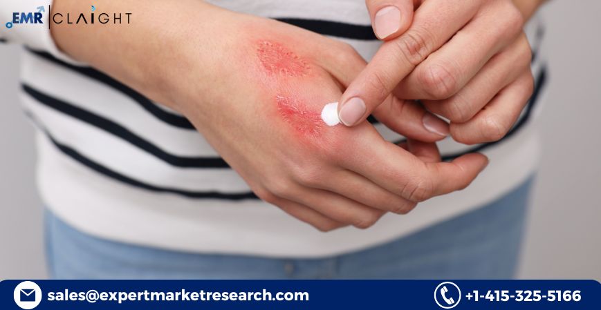 Topical Pain Relief Market