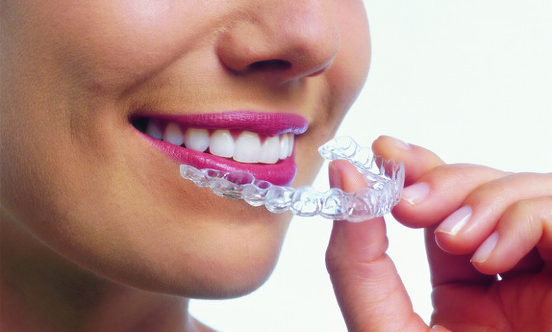 jupiter dentist providing invisalign