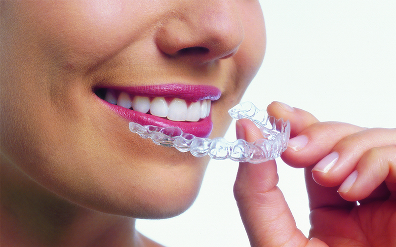 jupiter dentist providing invisalign