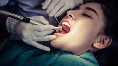 Root Canal Therapy