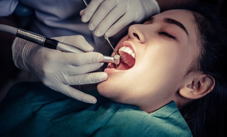 Root Canal Therapy
