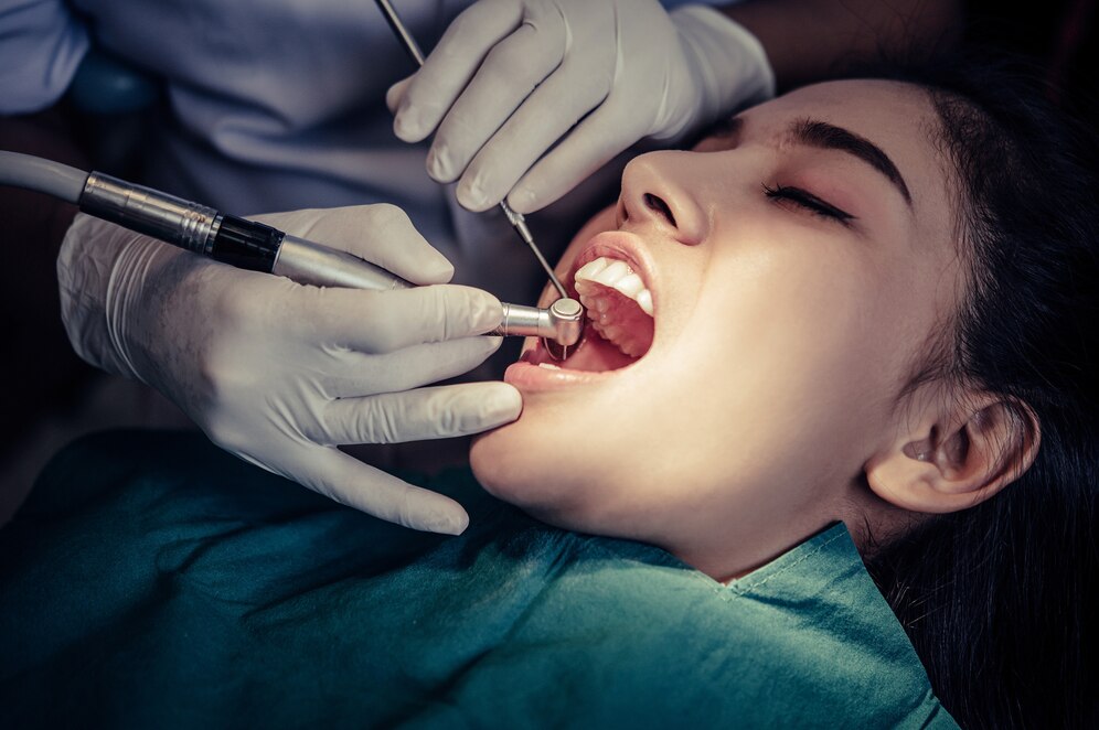 Root Canal Therapy