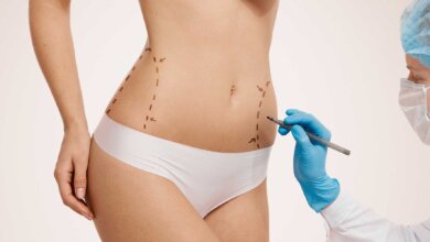 Body Jet Liposuction vs. CoolSculpting Which Fat Reduction Method Is Better