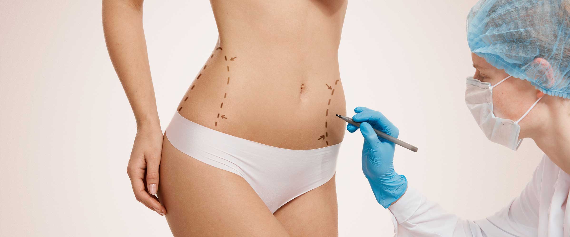 Body Jet Liposuction vs. CoolSculpting Which Fat Reduction Method Is Better
