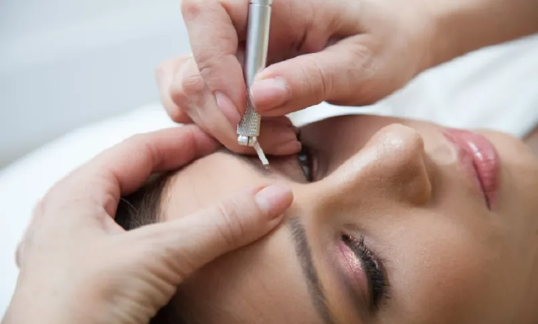 Hormones, Genetics, and Eyebrows When to Consider a Transplant