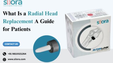 What Is a Radial Head Replacement