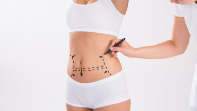 Insurance and Liposuction What’s Covered and What’s Not