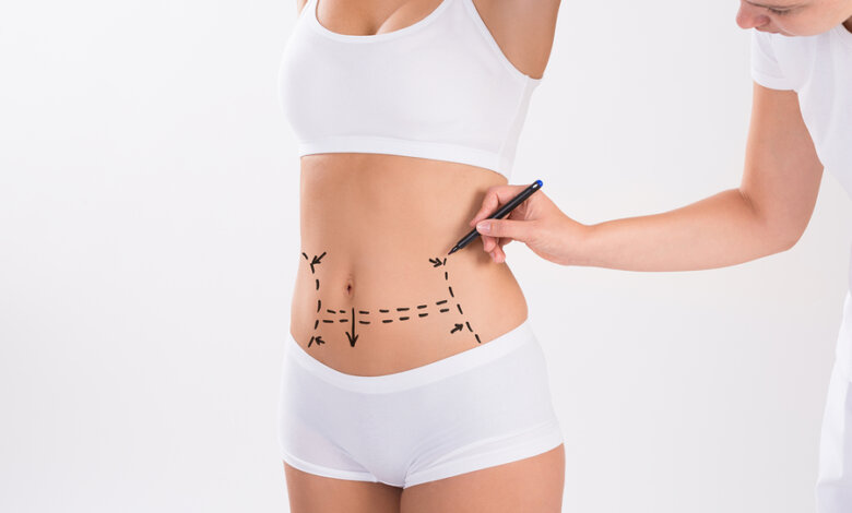 Insurance and Liposuction What’s Covered and What’s Not