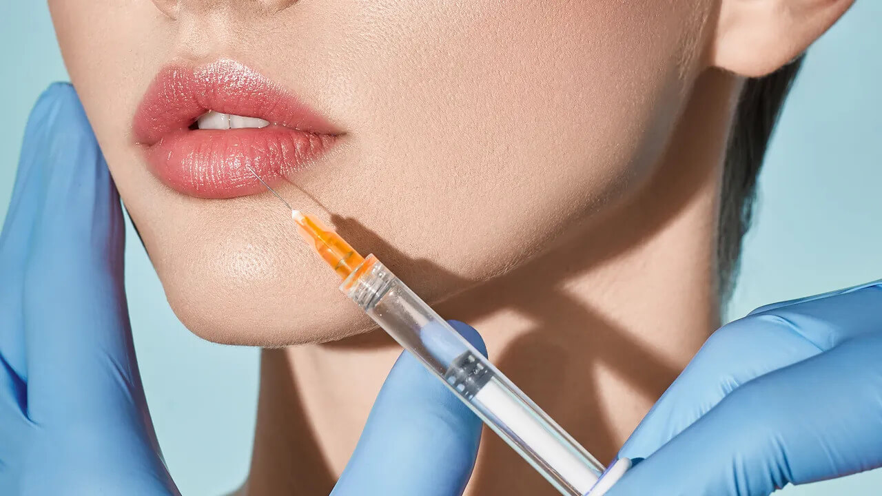 Lip Filler Injections Trends, Techniques, and What’s New