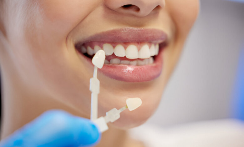 The Benefits of Porcelain Veneers for Flawless Smile in Corsicana, TX