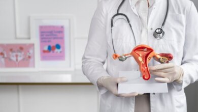 Uterine fibroids