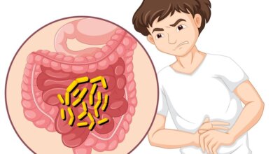 What Worms Does Fenbendazole Treat