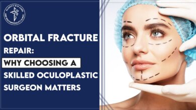 oculoplastic surgeon in Lucknow