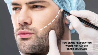 beard restoration