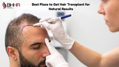 best place to get hair transplant