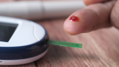 blood glucose monitoring