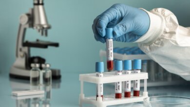 Blood Plasma and Serum