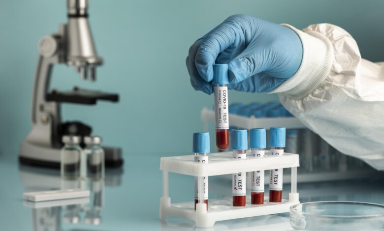 Blood Plasma and Serum