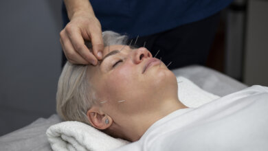 needling dry