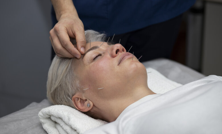 needling dry