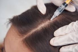 https://lejeunemedspa.com/services/prp-gfc-for-hair-loss