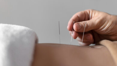 Acupuncture therapy targeting back pain, emphasizing the advantages of natural pain relief and Moxa treatment.