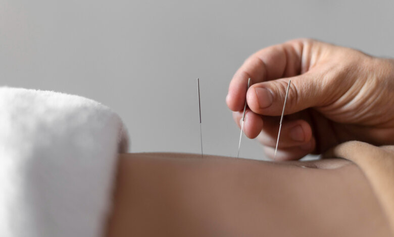 Acupuncture therapy targeting back pain, emphasizing the advantages of natural pain relief and Moxa treatment.