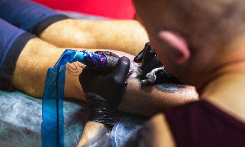 Best Tattoo Removal Boston
