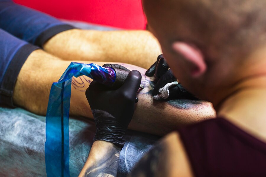 Best Tattoo Removal Boston