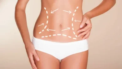 Liposuction in Riyadh