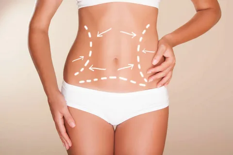Liposuction in Riyadh