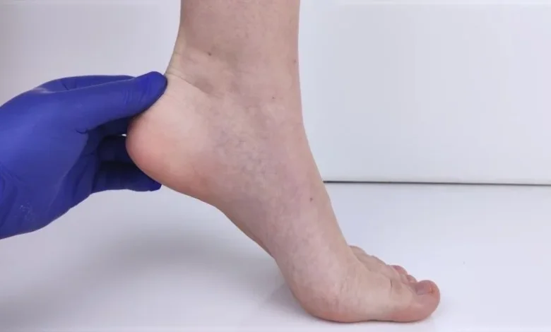 5 Rare Foot Disorders Explained with Symptoms in Edinburgh