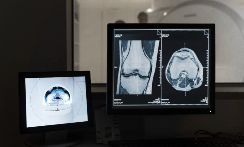 CT Scan Images