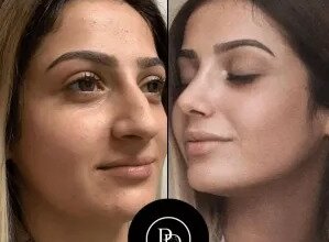 Best Aesthetic Clinic in Dubai