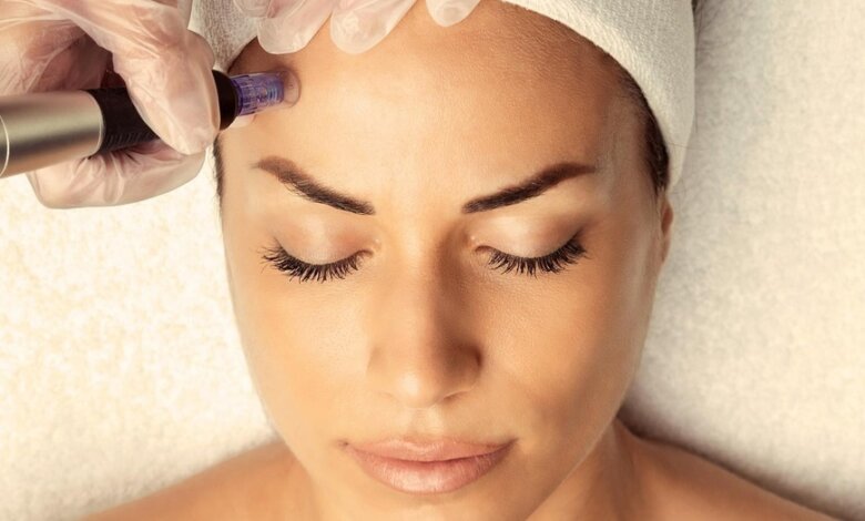 Derma Pen vs. Traditional Microneedling Explained