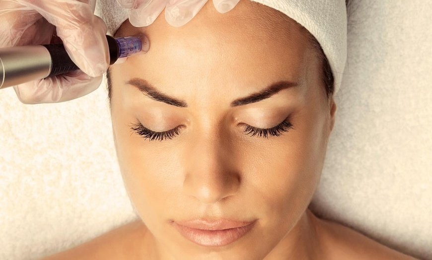 Derma Pen vs. Traditional Microneedling Explained