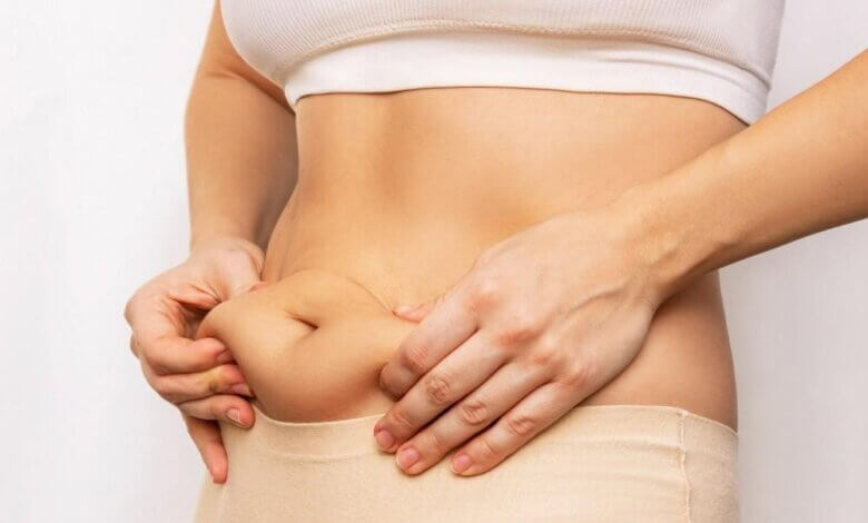 Liposuction in Dubai